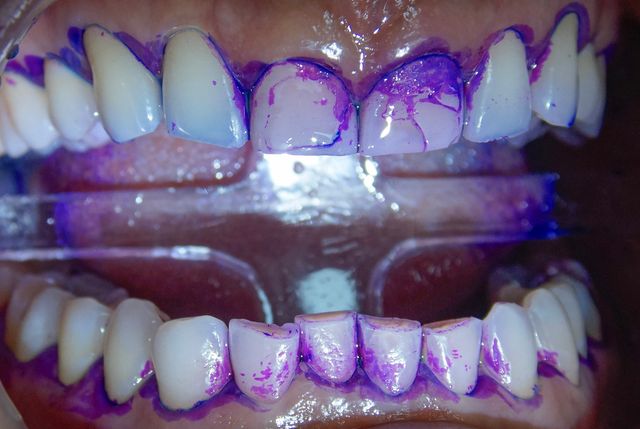 Ampliar imagen: Pilares 108