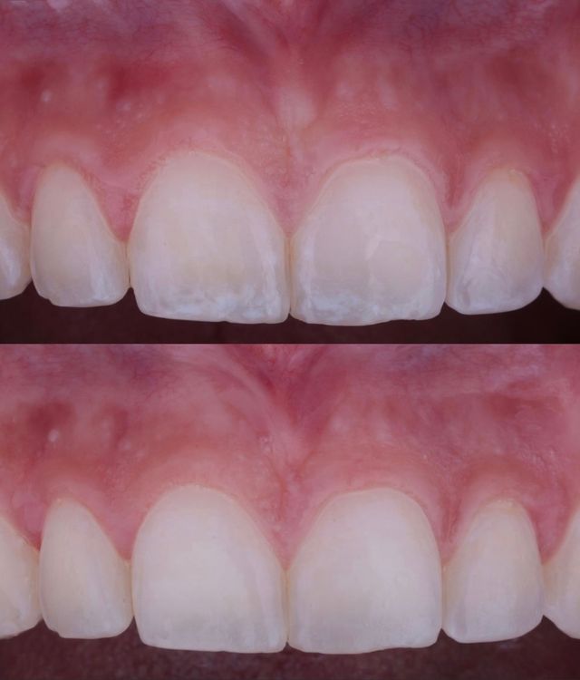 Ampliar imagen: Dental Bel