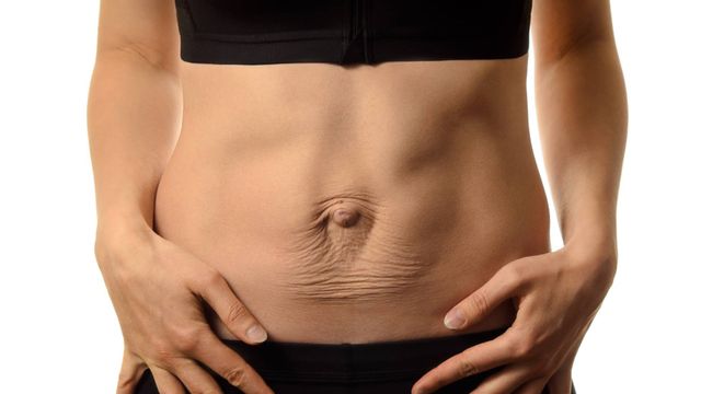 Ampliar imagen: HerniaQx Centro Especializado en Hernias y Reconstrucción de Pared Abdominal