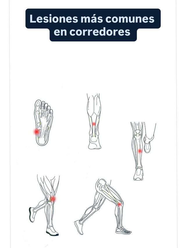Ampliar imagen: -Fisioterapia Deportiva