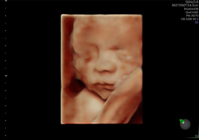 Ampliar imagen: Morelia/ GCEM