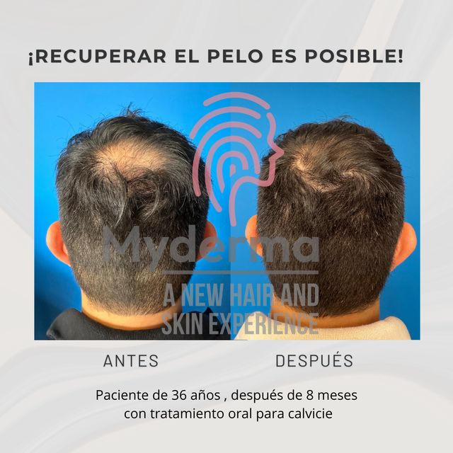 Ampliar imagen: Myderma Hair&Skin