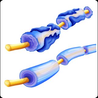 Ampliar imagen: Centro Integral para la Atención de Neuropatía y Dolor CIANyD