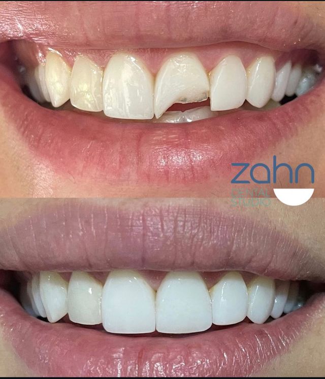 Ampliar imagen: zahndentalstudio