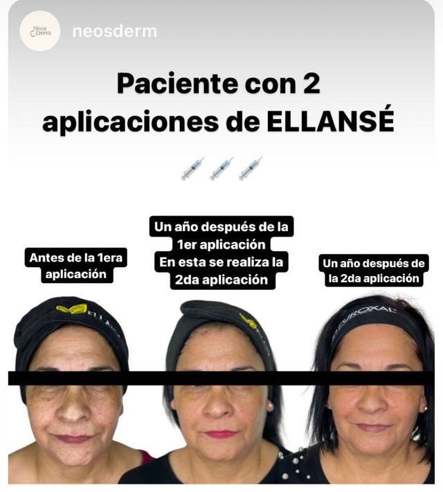 Ampliar imagen: Clinica Dermatologica Neos Derm