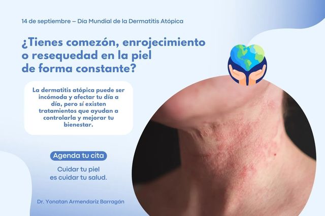 Ampliar imagen: Dermatólogo en Bari Reserve (La Minerva)
