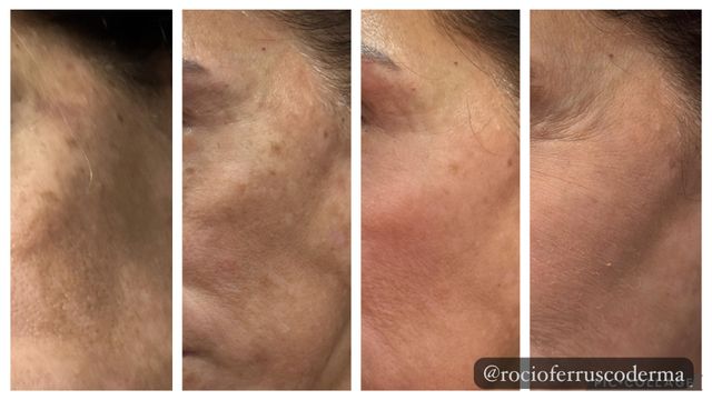 Ampliar imagen: Sanatorio del Carmen