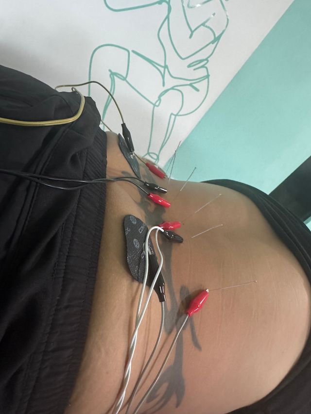 Ampliar imagen: Neuromuscular. Fisioterapia y Rehabilitación