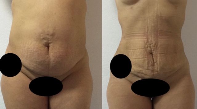 Ampliar imagen: SILUETTE CLINICA ESTÉTICA & SPA