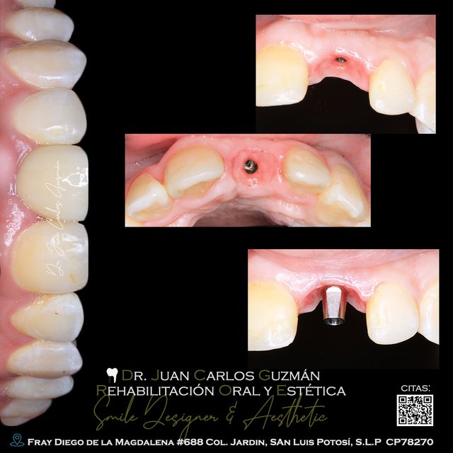 Ampliar imagen: Dr. Juan Carlos Guzmán - Rehabilitación Oral y Estética