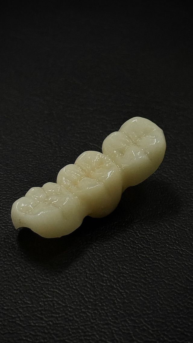 Ampliar imagen: Clínica Dental Avacer