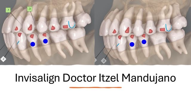 Ortodoncia, ortopedia y disfunción temporomandibular