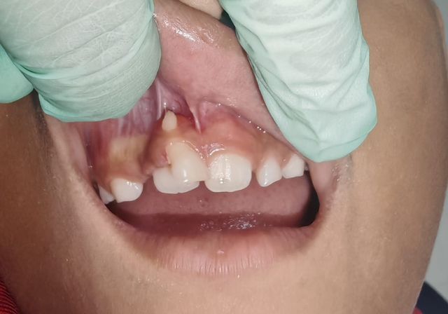 Ampliar imagen: Dra. Fernanda Cortés Torres ODONTOPEDIATRA