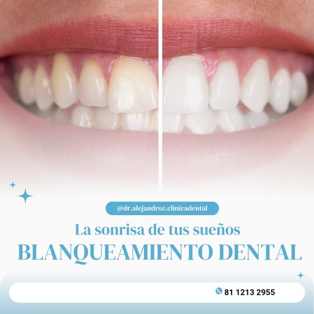 Ampliar imagen: implantologia-consulta en línea