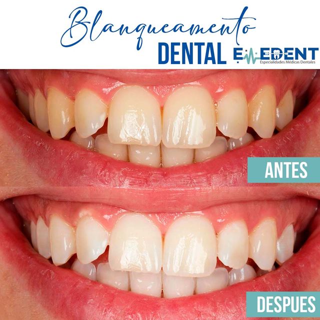 Ampliar imagen: EMEDENT