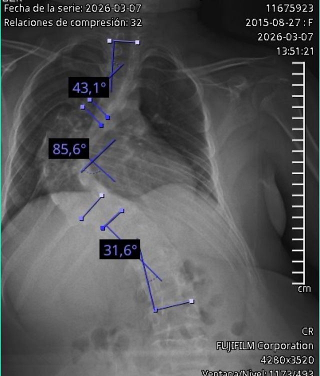 Ampliar imagen: Consultorio Saltillo Traumatología y Columna Vertebral SaltilloSpine Hospital Santa Elena