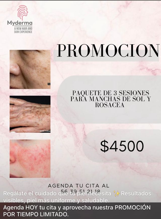 Ampliar imagen: my derma hair & skin new experience