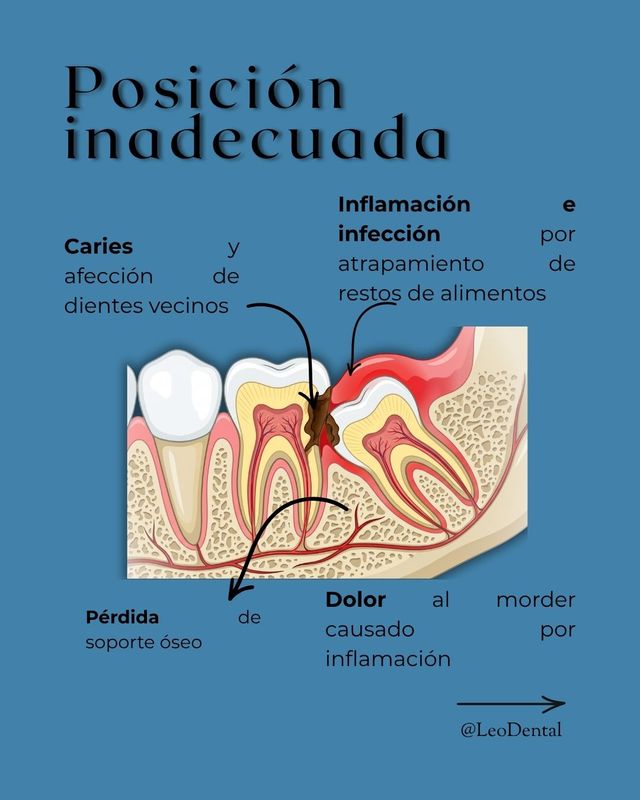 Ampliar imagen: Leo Dental