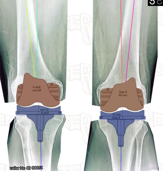 Ampliar imagen: Traumatología y Ortopedia Dr. Valle