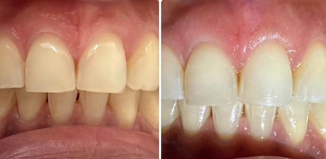 Ampliar imagen: CONSULTORIO DENTAL - Dra. Linda Ixtazu Lujano Salgado