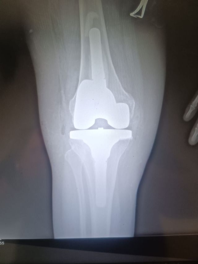 Ampliar imagen: Dr. Erick García - Cirugía Articular Hombro y Rodilla (Médica Valle)