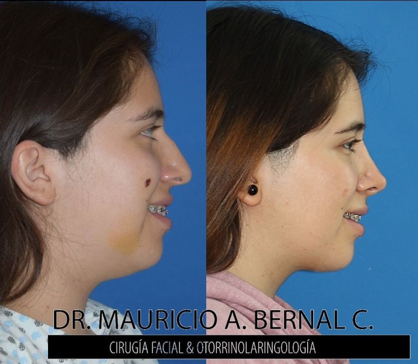 Mauricio Alejandro Bernal Carreon-34