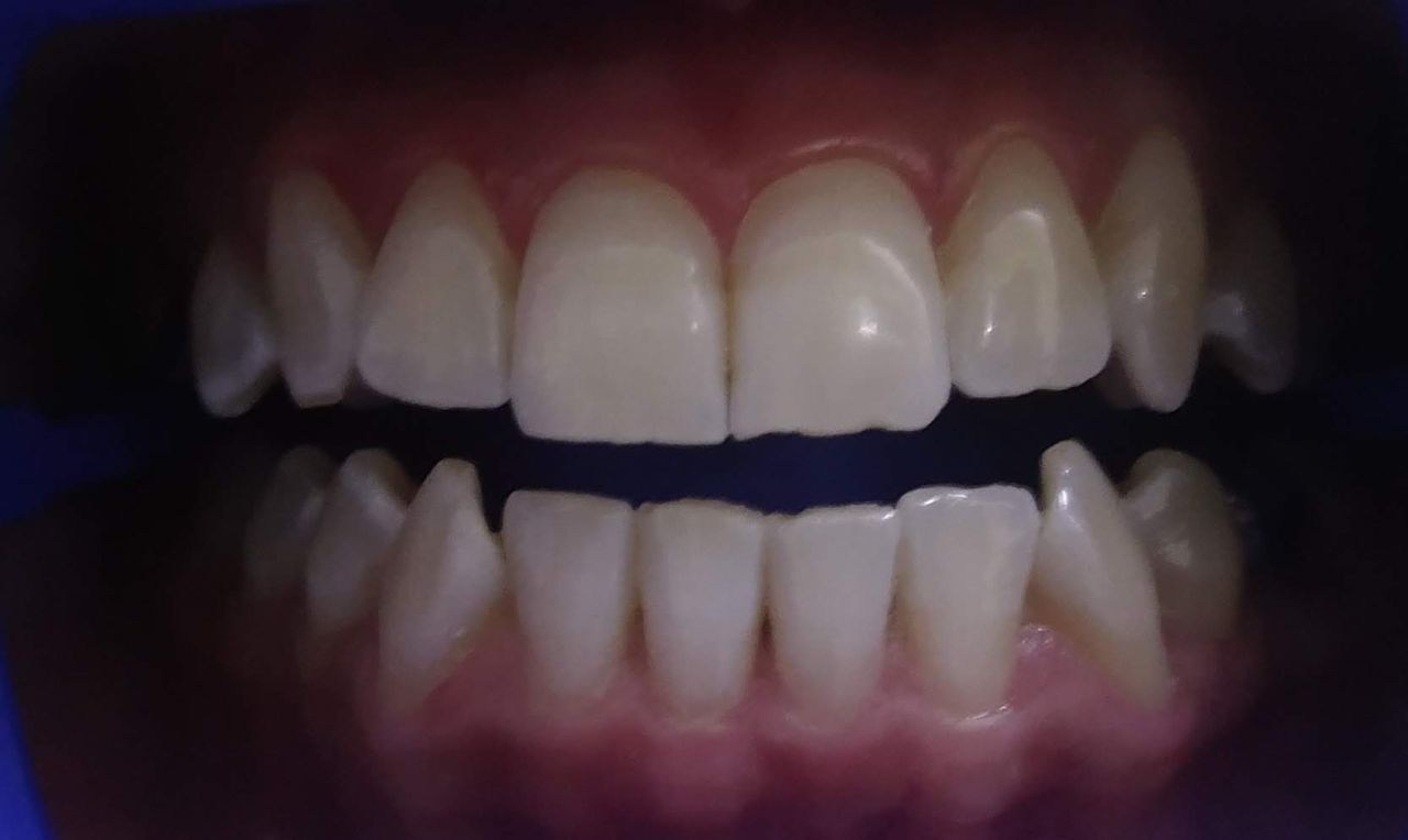 Petra Albarran Calzonzin-1