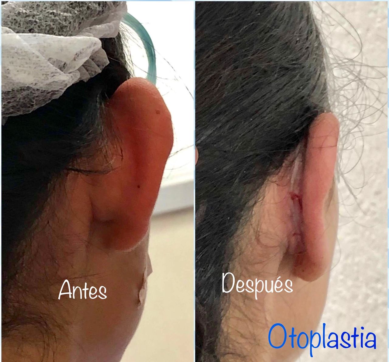 Ana Guadalupe Torres León-4