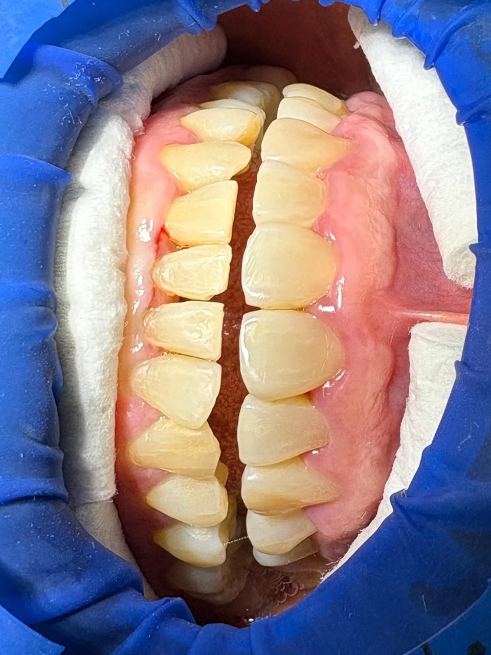 Arturo Romero Grande-41