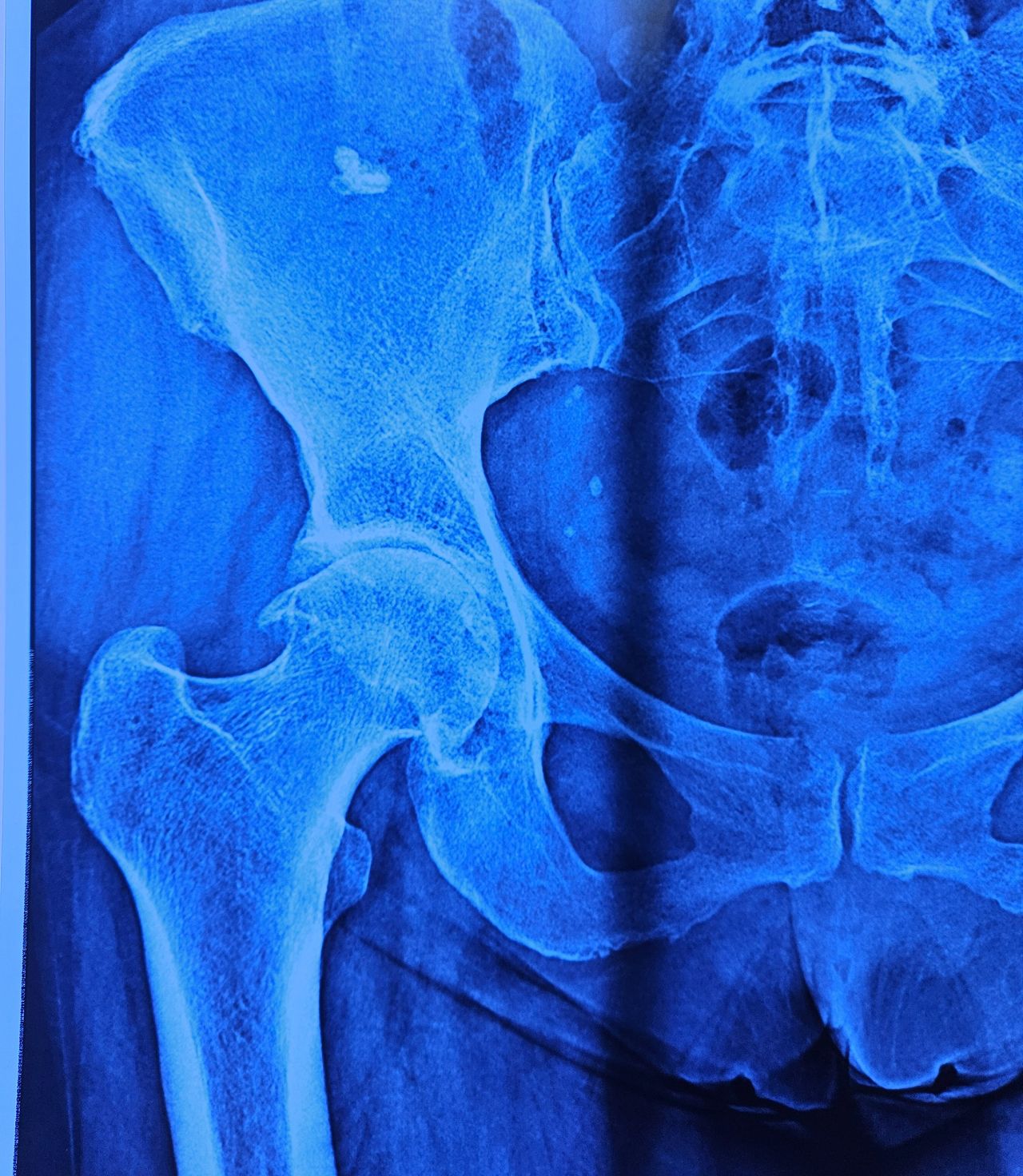 Juan Miguel Vargas Martínez-10