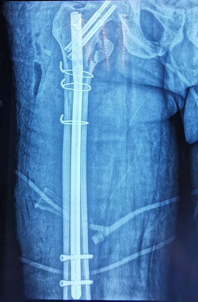 Josmar Adrián Lopez Eng-1