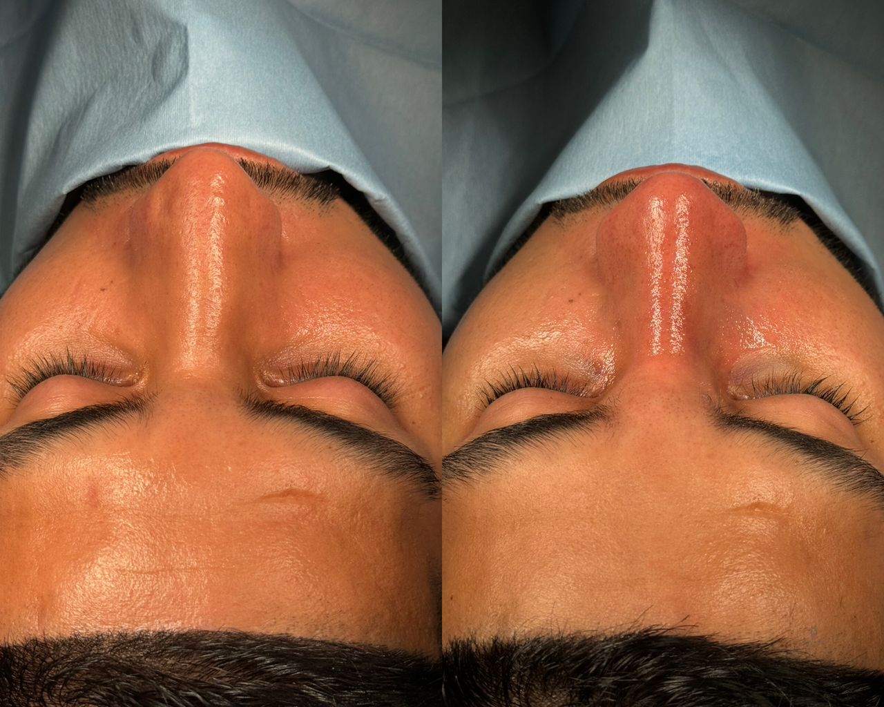 Angel Castro Urquizo-59