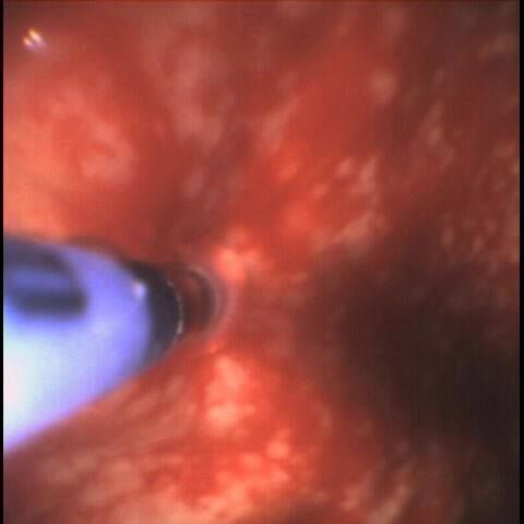 Alejandro Marin Castañeda Baron-23