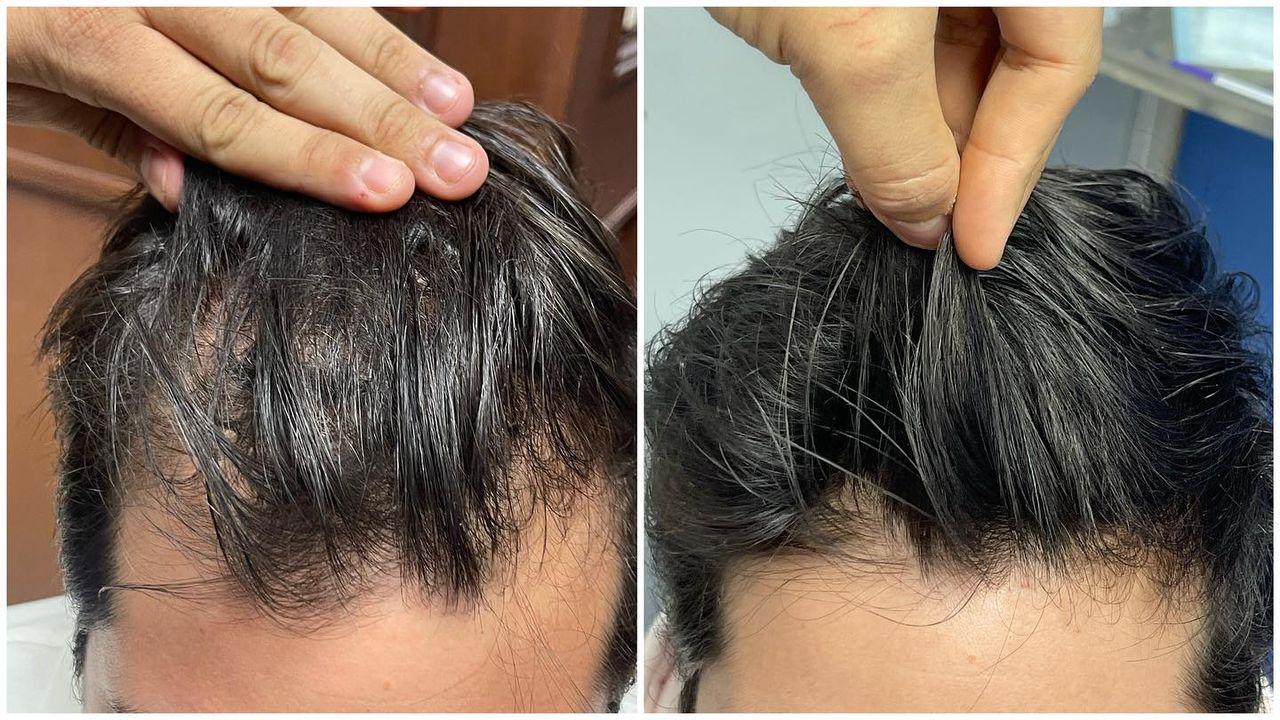 Adrián Martínez Moreno-2