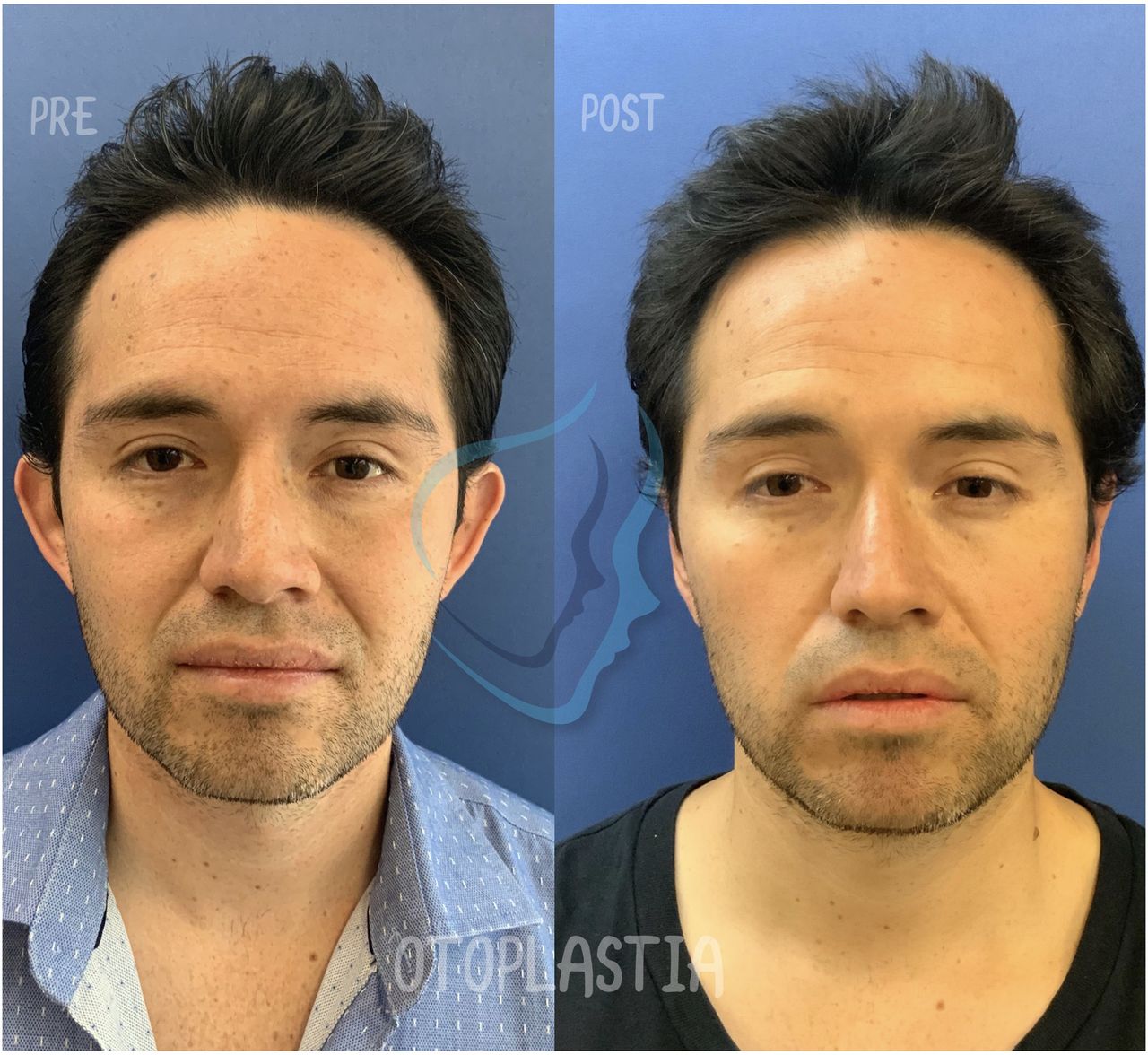 Giuseppe Tanzillo-80