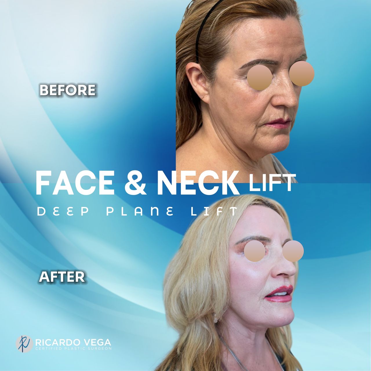 Ricardo Vega Montiel-9