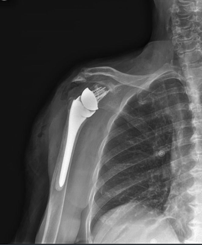 Jorge Manuel Valadez Soto-21