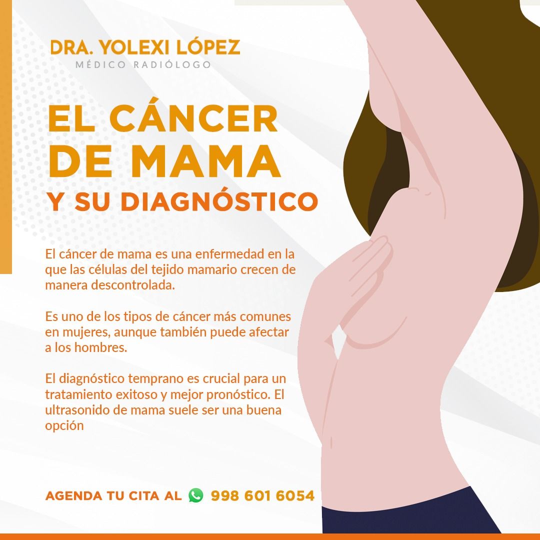 Yolexi López Neyra-1