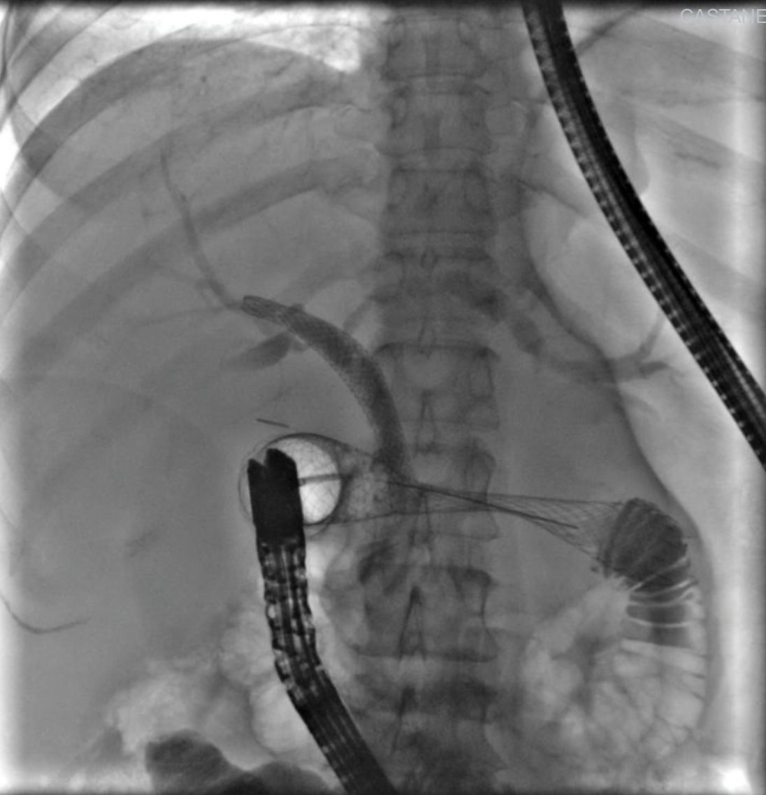 Everardo Muñoz Anaya-10