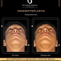Enrique Serrano Cruz-9
