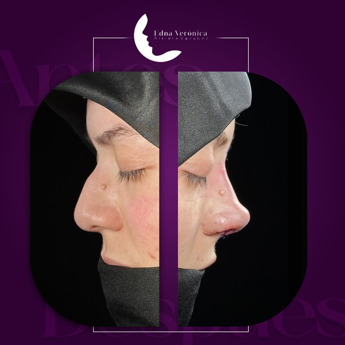 Edna Verónica Arrieta Vázquez-8