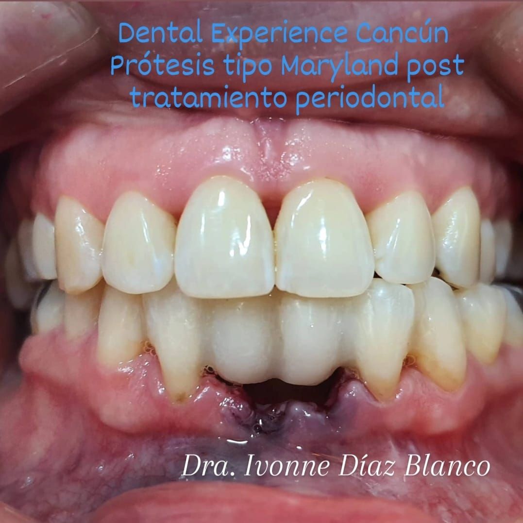 Ivonne Diaz Blanco-10