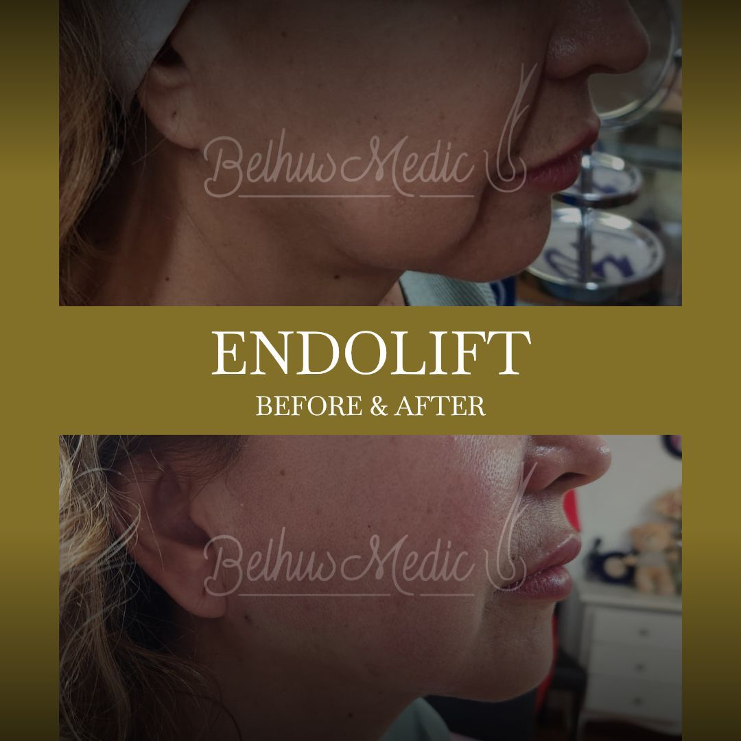 Alejandra Soriano Elorza-87