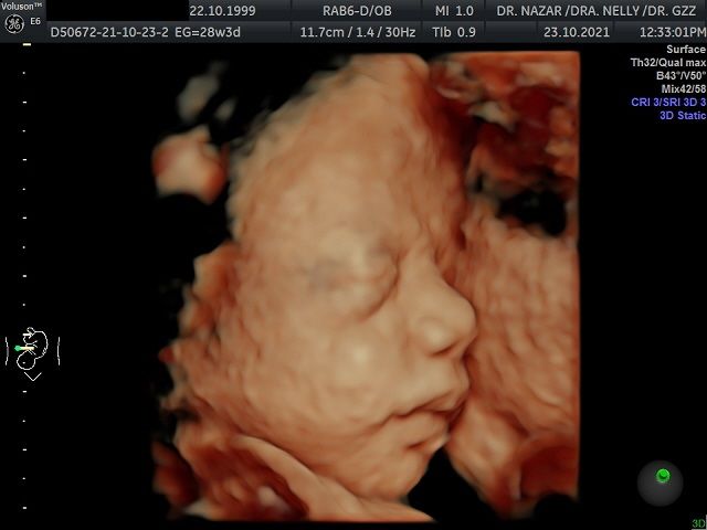 Miguel Angel González Nazar-11