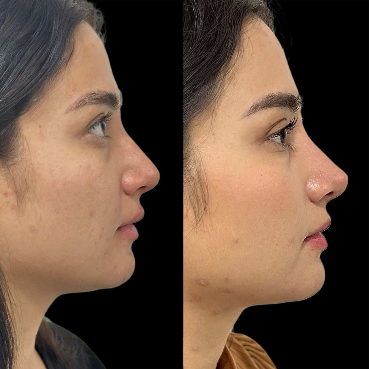 Ramiro Chávez Montoya-3