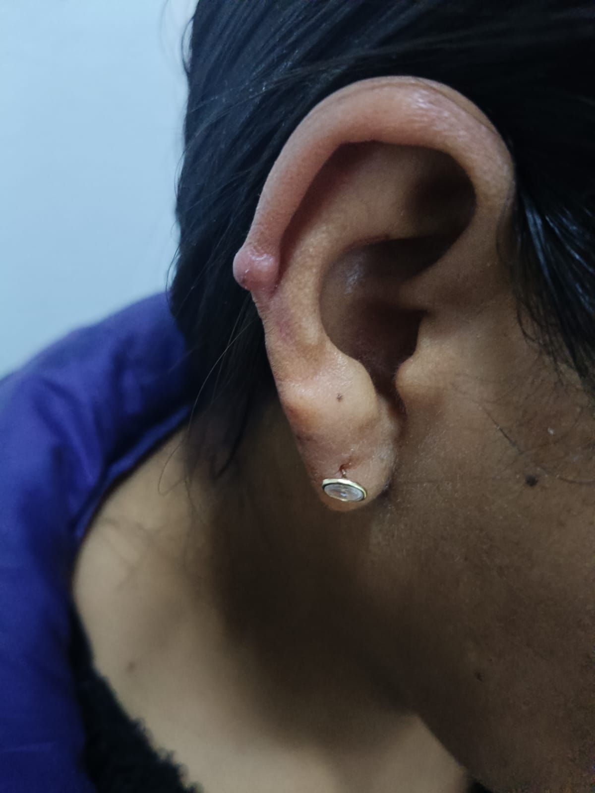 Alejandro Irisson-37