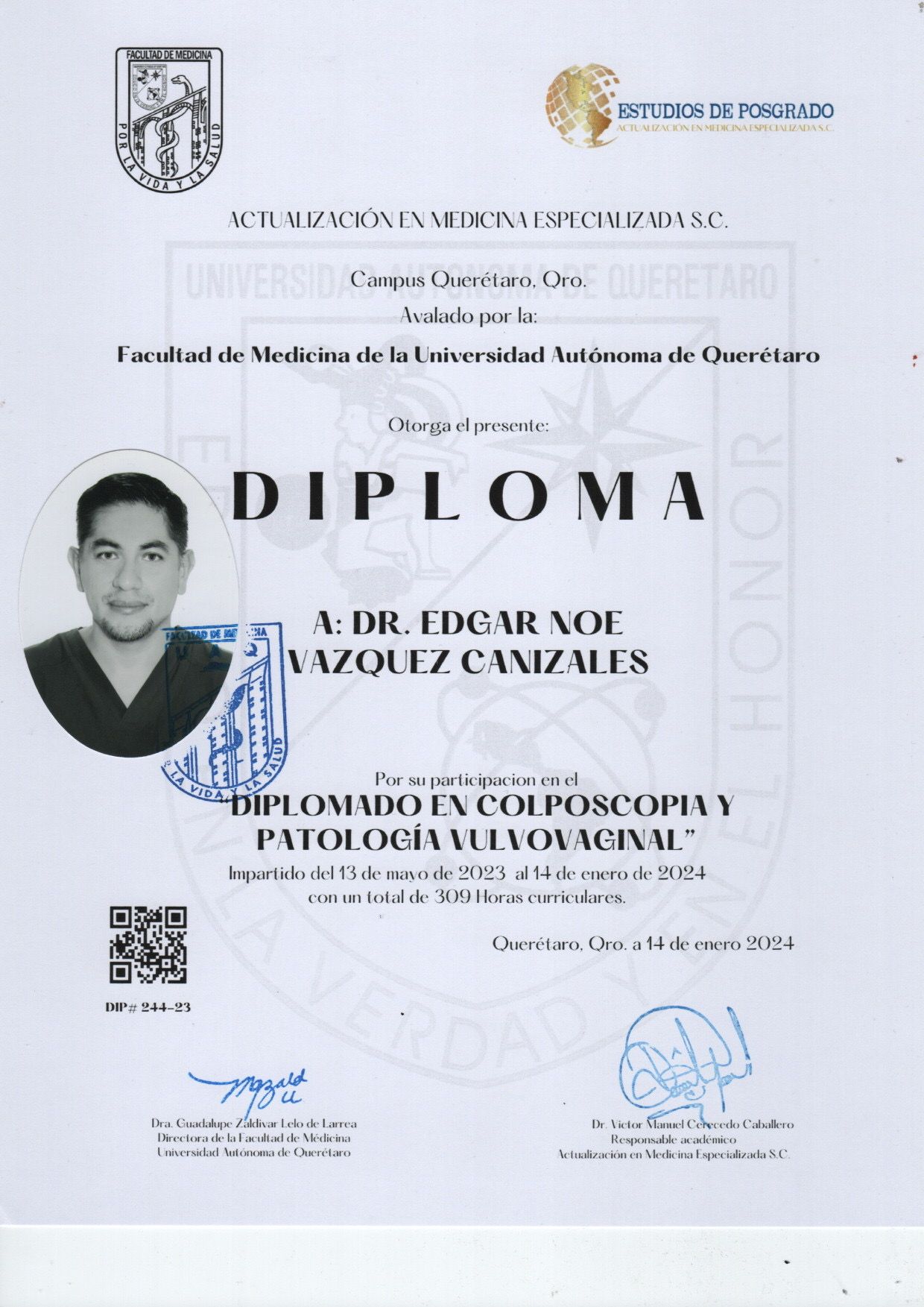 Edgar Noe Vázquez Canizales-2