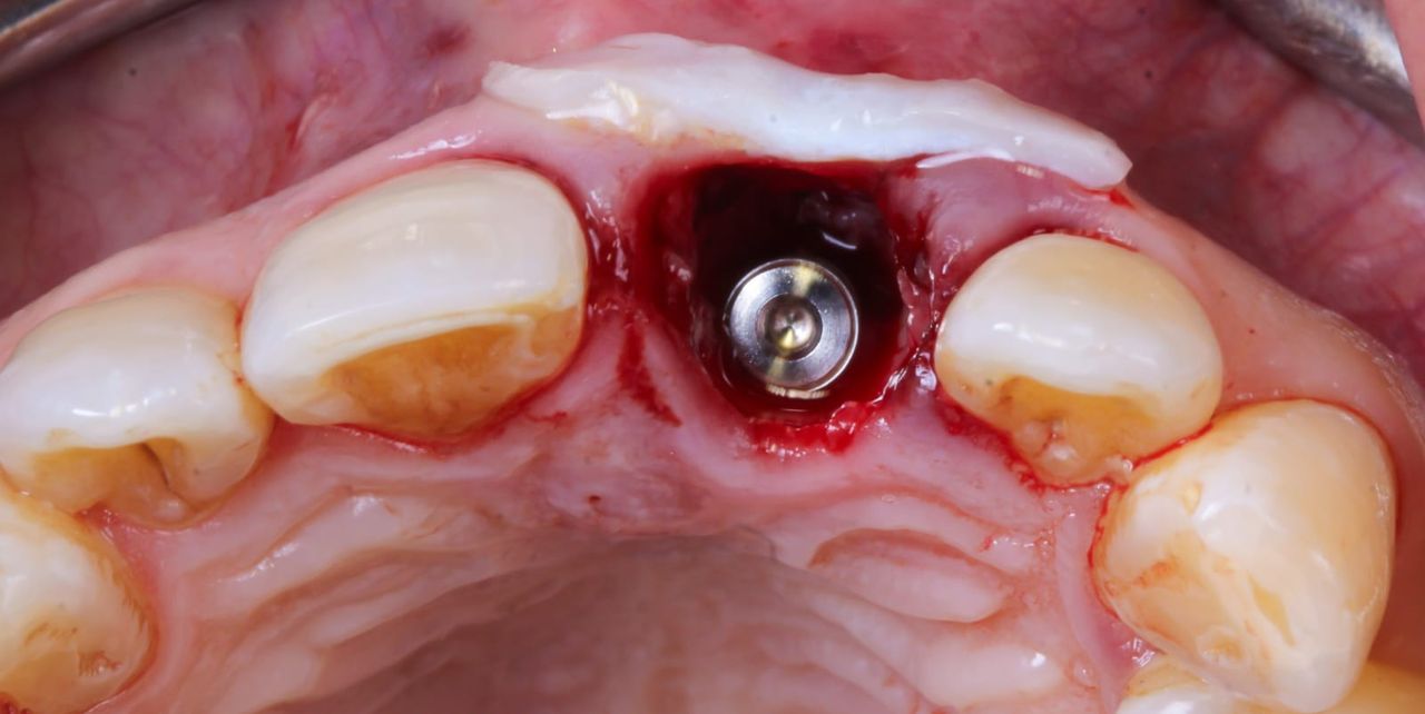 Hugo Enrique Aguilar Lamas-11