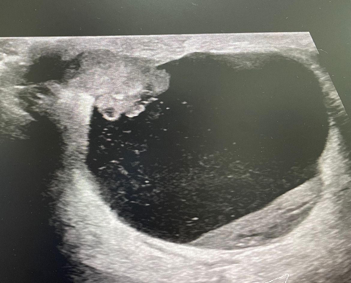 Juan José Solano Perez-3