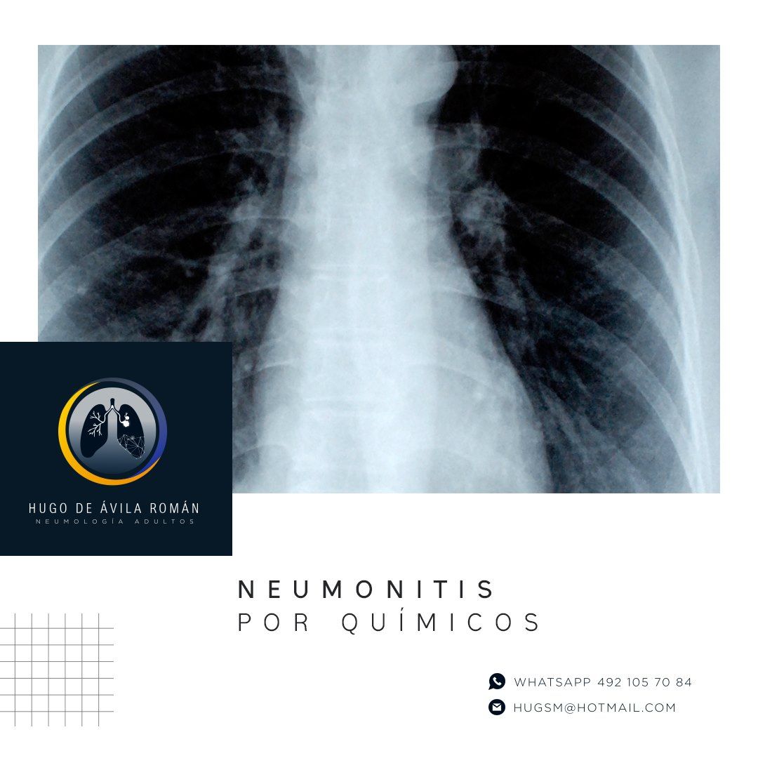 Hugo De Ávila Román-1